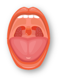 Mucositis
